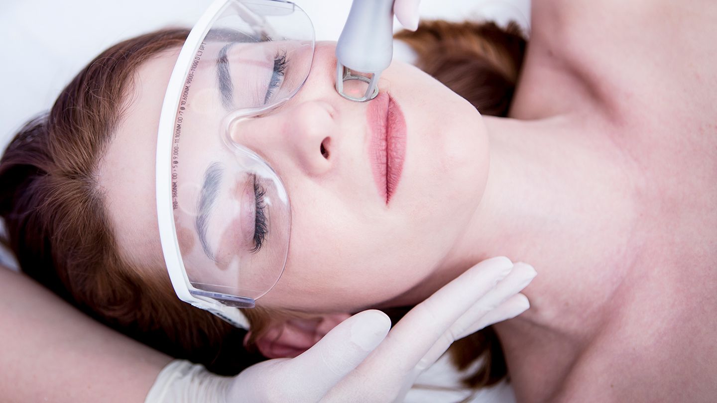What Are The Side Effects Of Laser Skin Treatment?